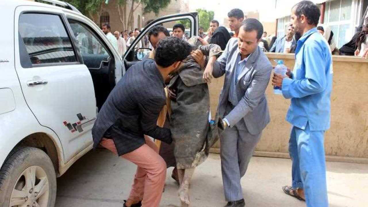 Yemenis helps a wounded child after being injured in an alleged Saudi-led airstrike