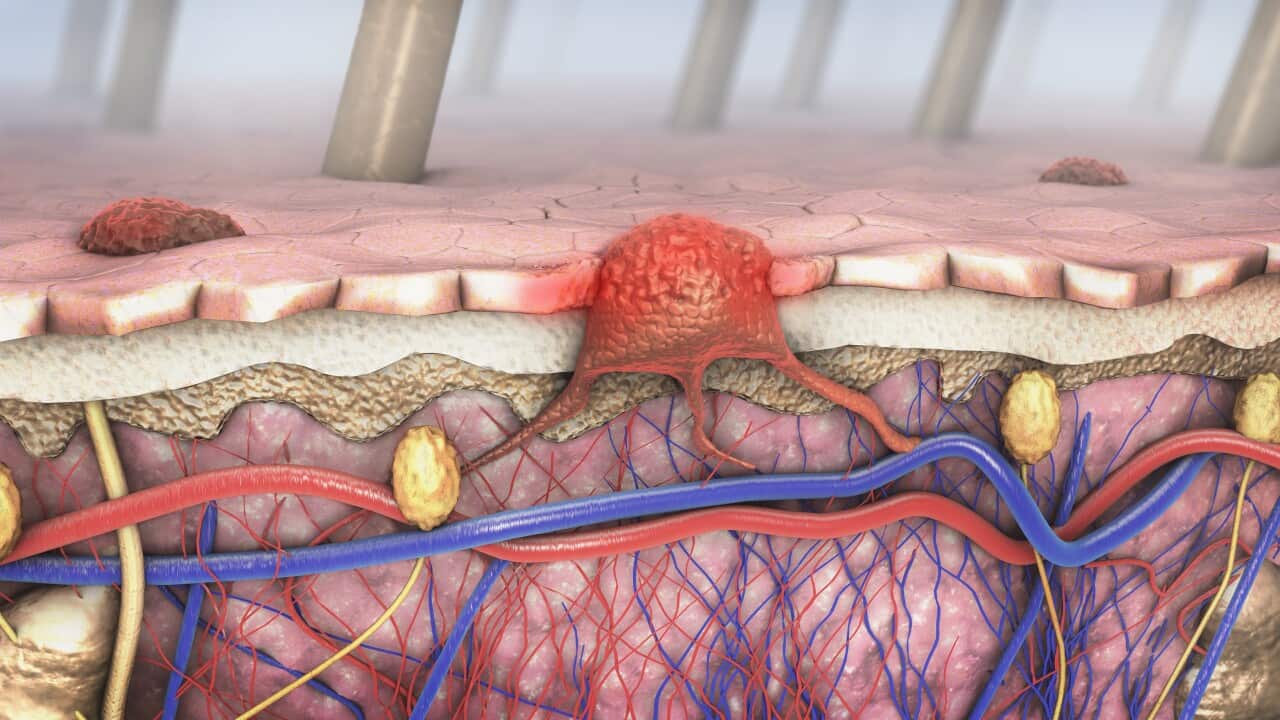 MELANOMA TREATMENT