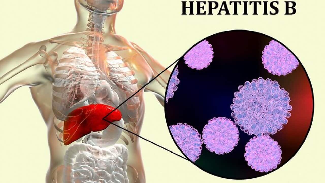 Hepatitis B infection, illustration