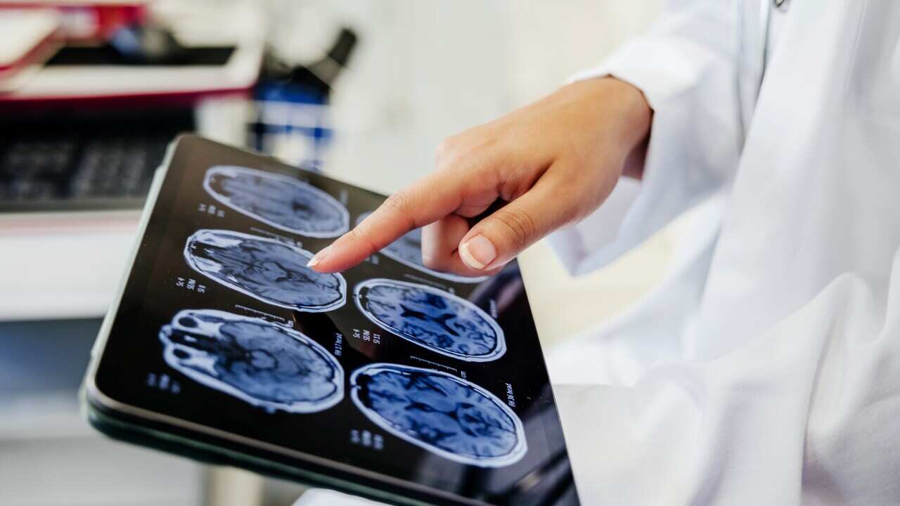 Close-up Shot of a Doctor's Hand Pointing on Brain Scan Images on Digital Tablet
