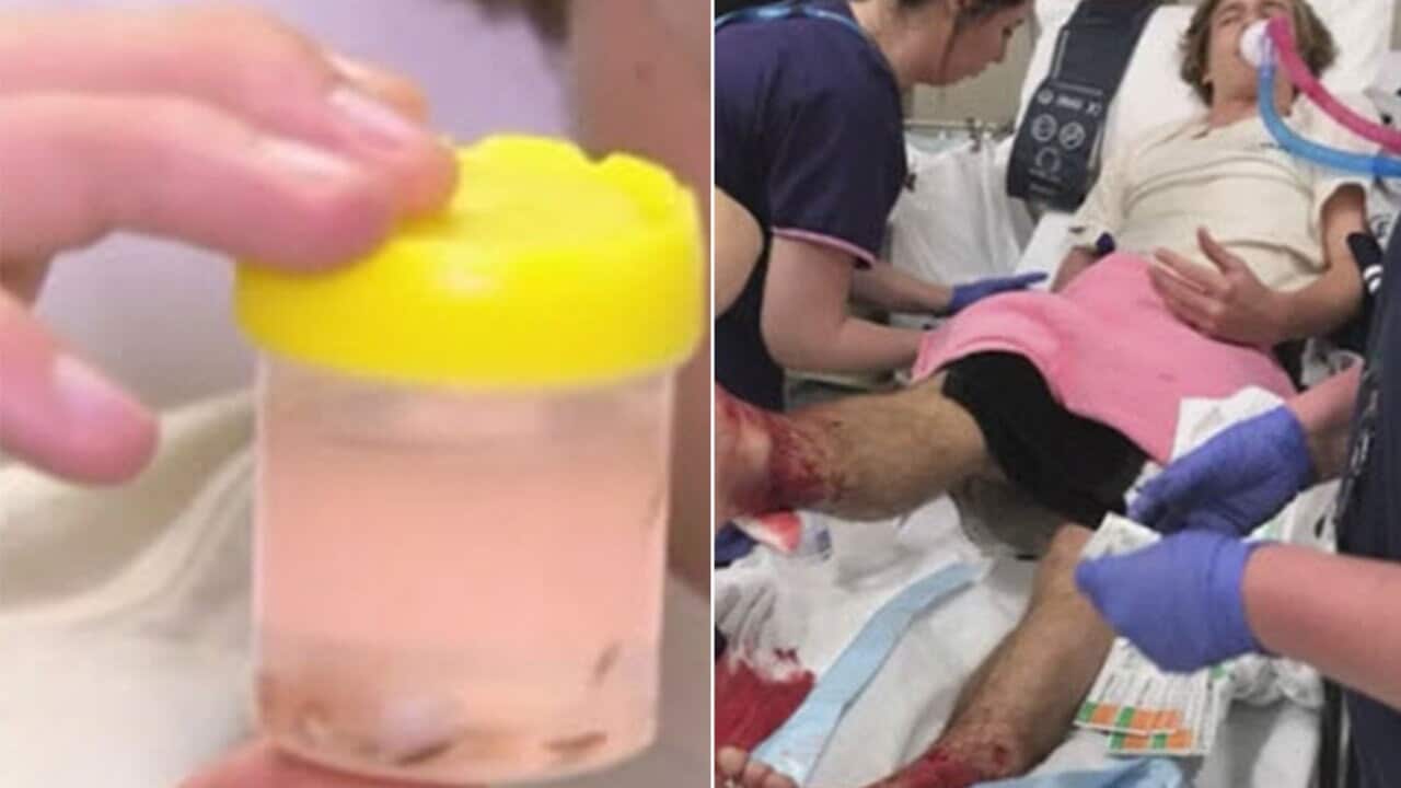 Sea crustaceans are to blame for a teenager's bloody Melbourne beach visit, a marine biologist says.