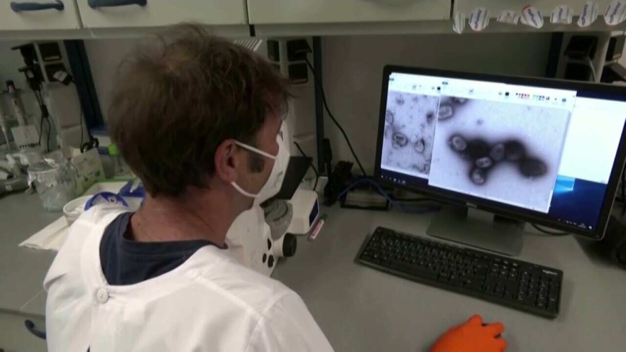 A scientist looks at a computer screen with an image of the monkeypox virus.