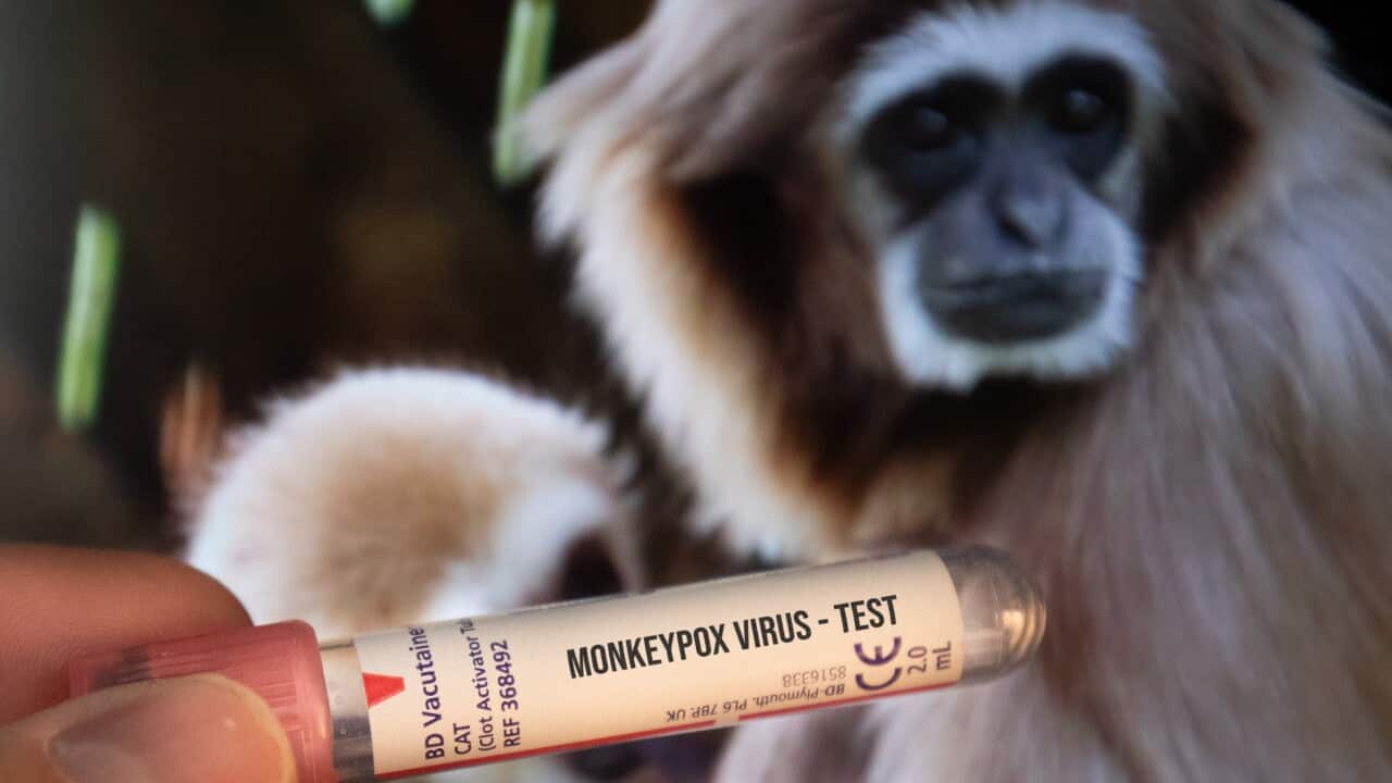 Test tubes labelled "Monkeypox virus" are seen in this illustration taken in Zagreb, Croatia on May 24, 2022. Photo: Davor Puklavec/PIXSELL.