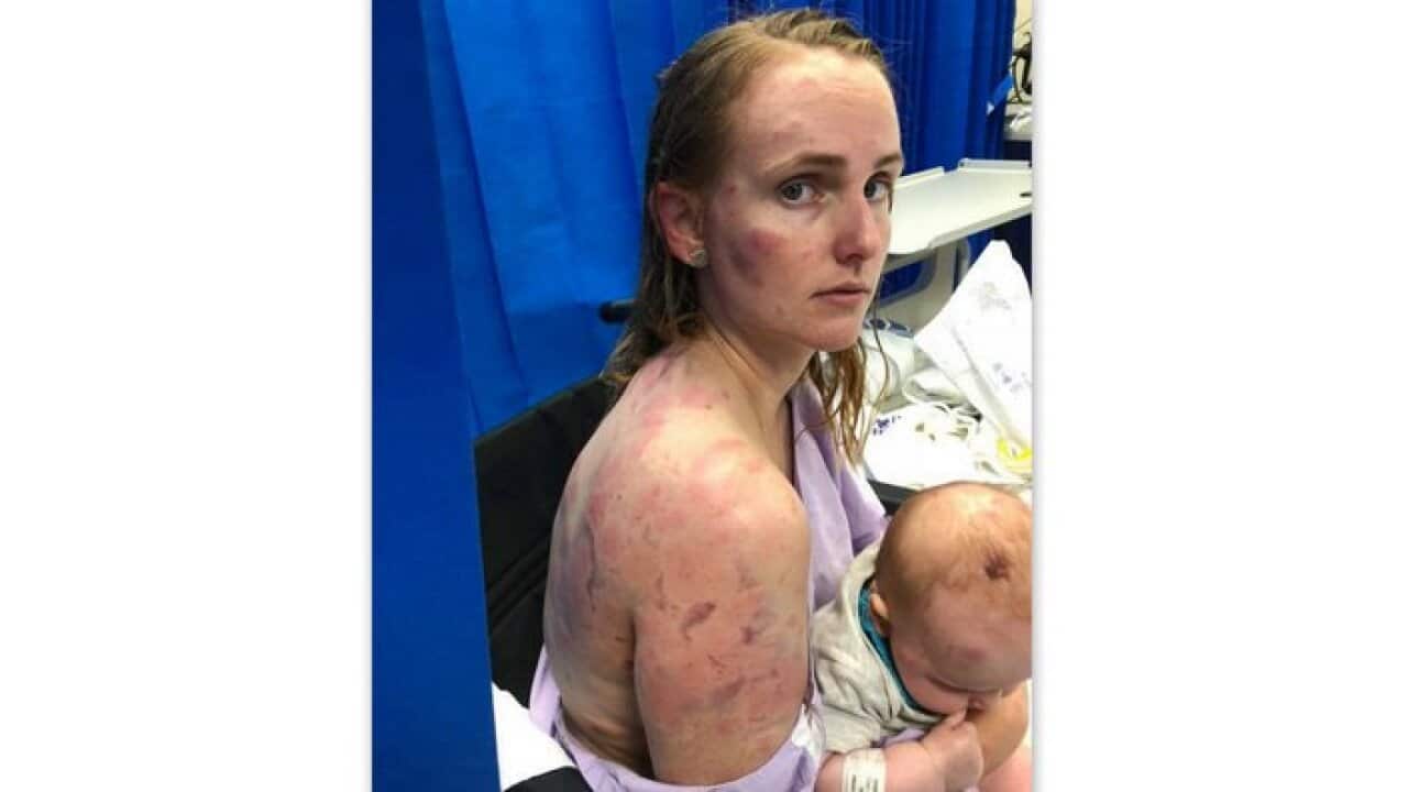 Injured mother shielded her baby and grandmother during hailstorm