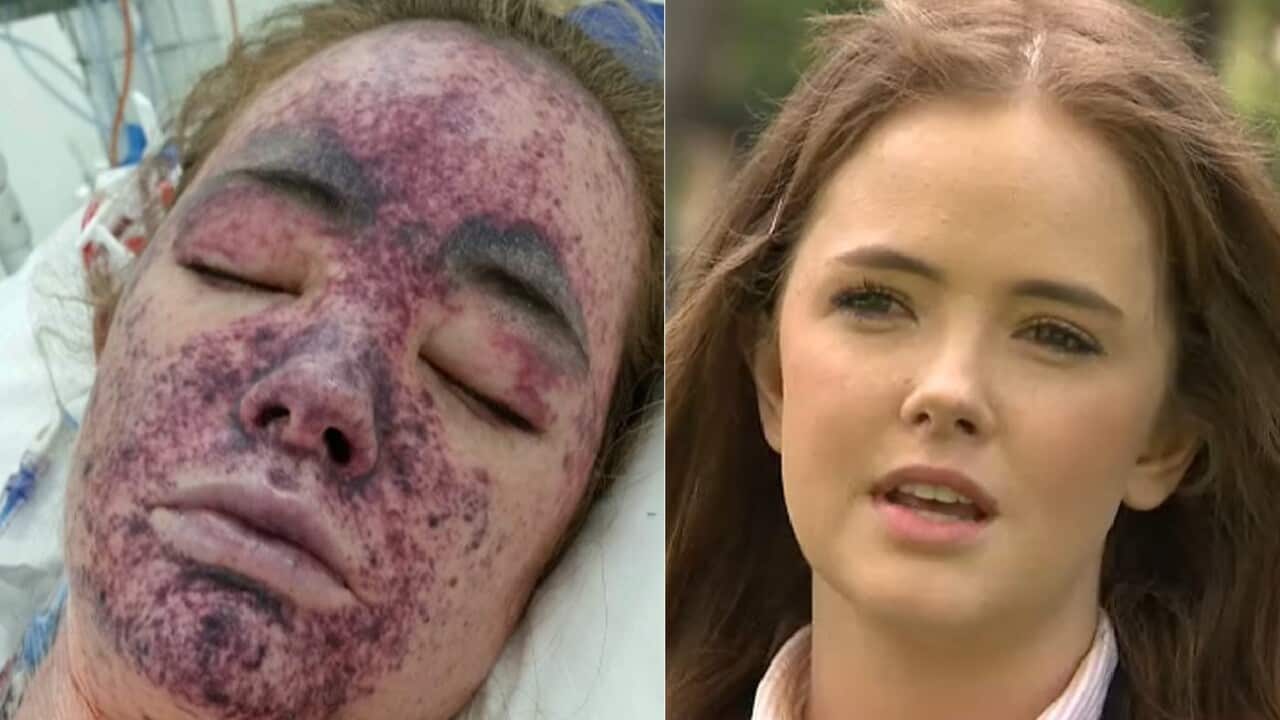 Lily O’Connell in hospital with meningococcal (L) and speaking to SBS News 