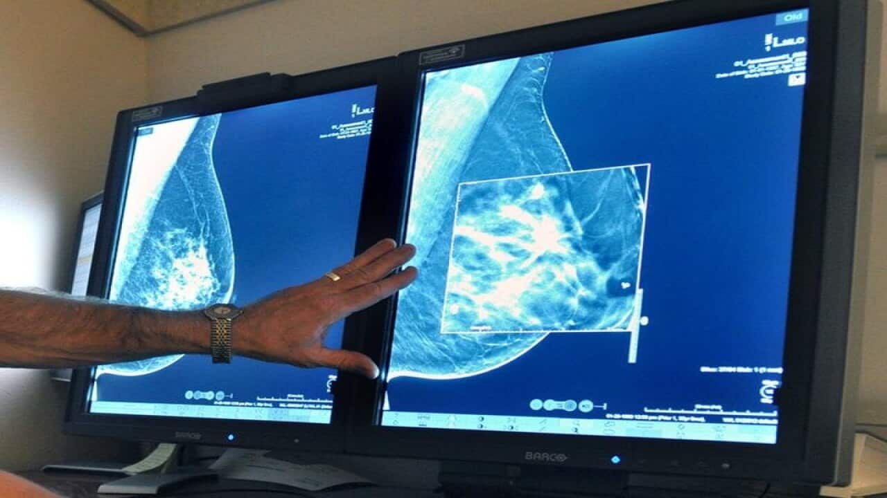 Mammogram breast cancer