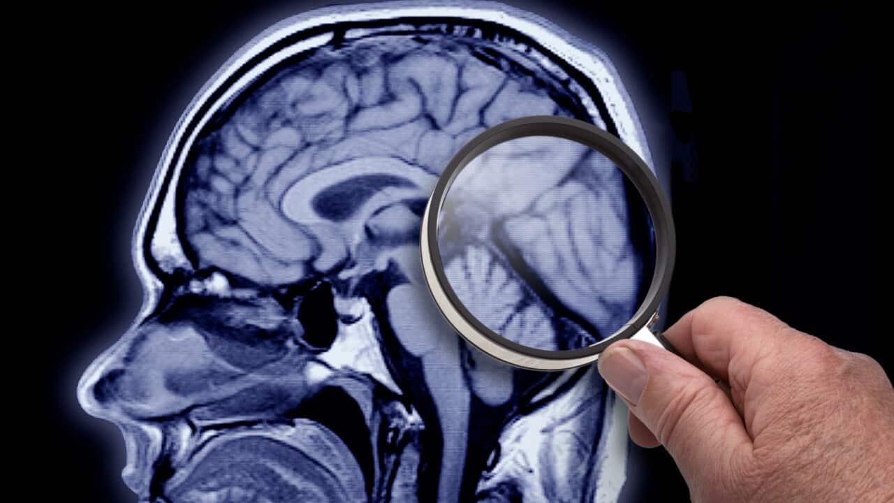 Das menschliche Gehirn wird immer noch erforscht