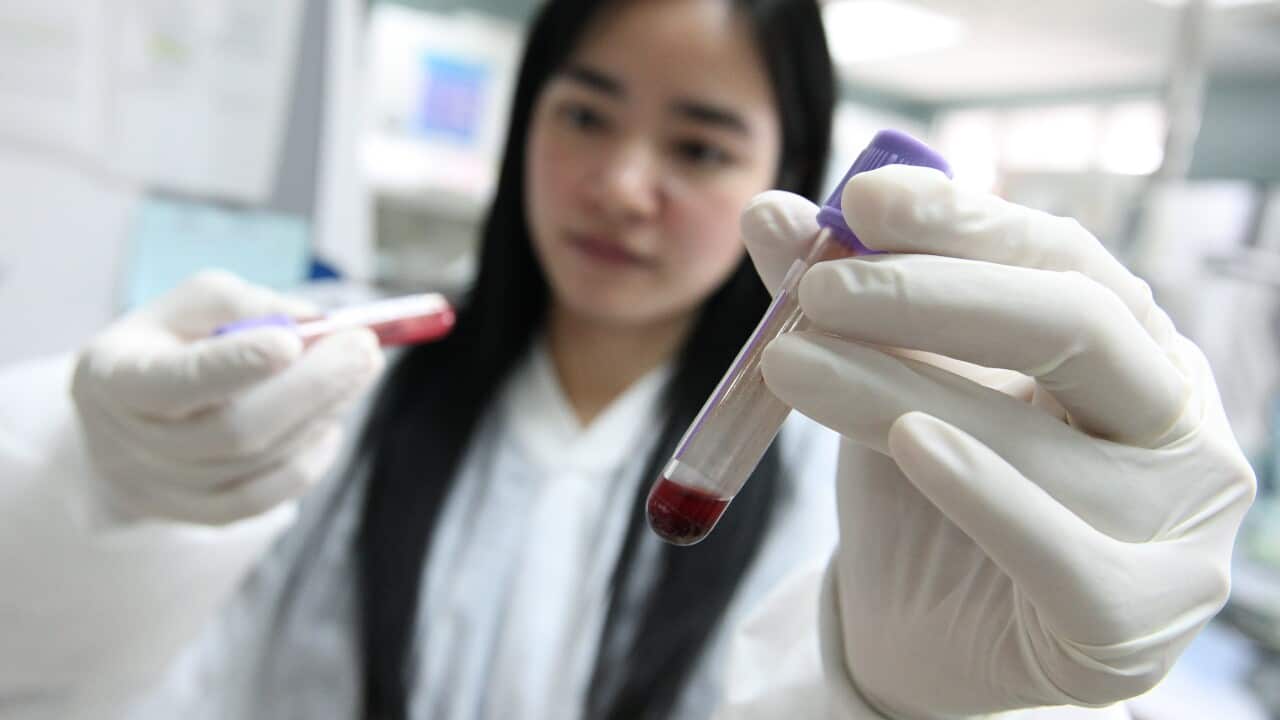 HIV, blood test, laboratory