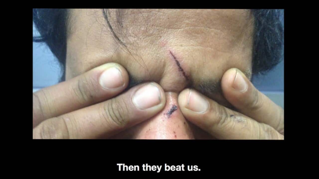 This testimonies and photos have been gathered from MSF patients in Serbia.