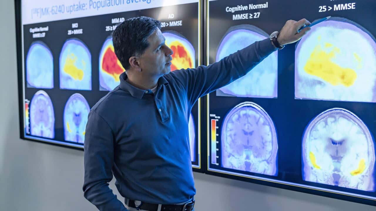 A man points to multicoloured brain scans.