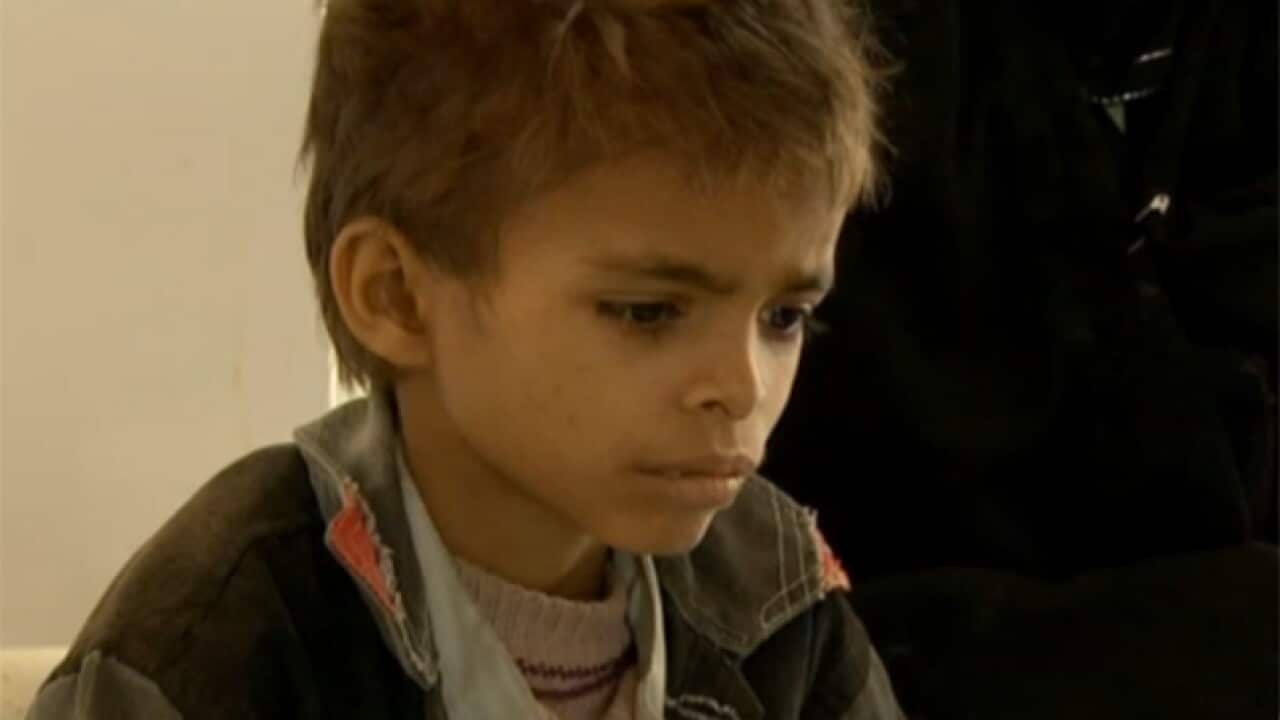 yemen_malnourished_120228_B_973803524