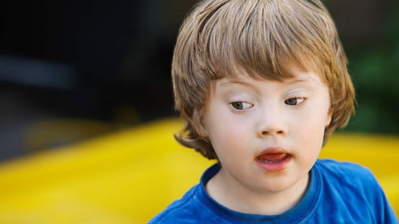 A boy with Down Syndrom