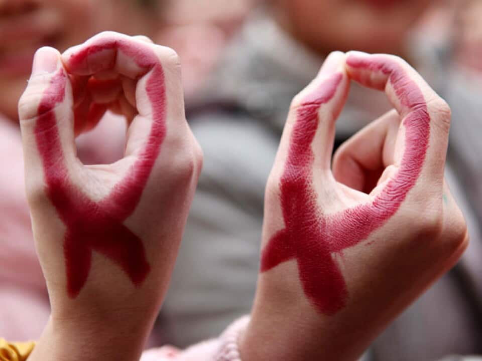 HIV