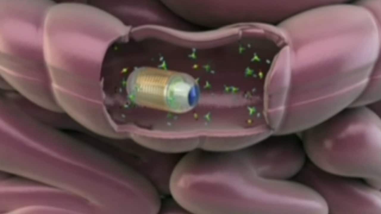 Image for read more article 'READ MORE'