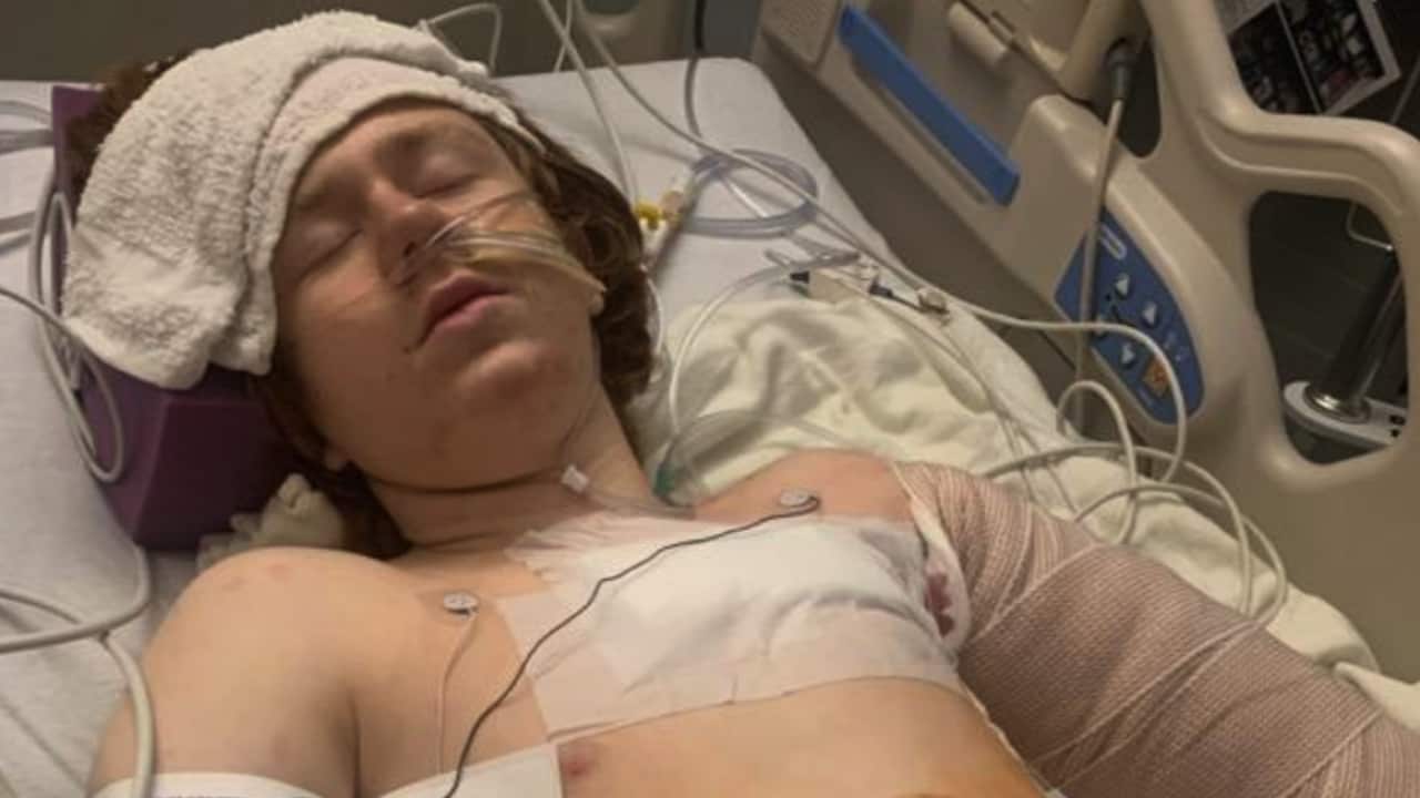 A 13-year-old boy with autism is recovering in hospital after being shot by police in Glendale, Utah.