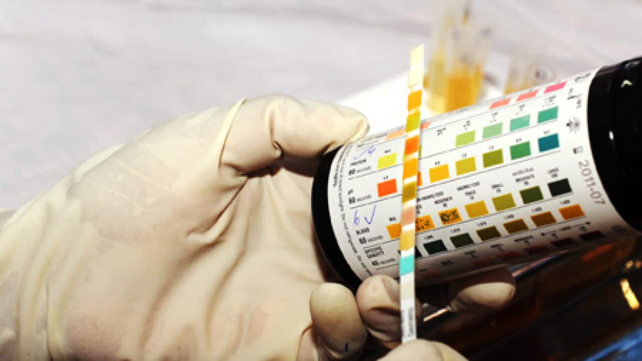 urine_test_100915_B_getty_1499434186