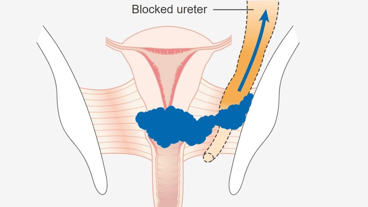 Image for read more article 'READ MORE'