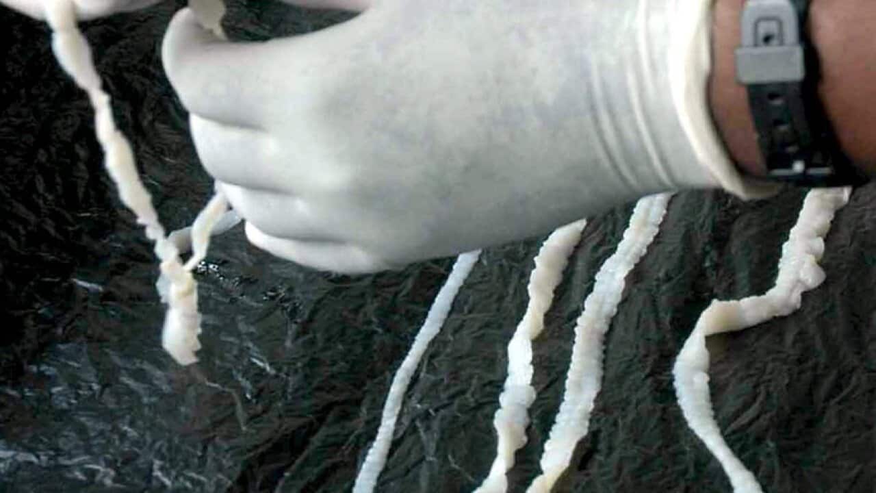 Tapeworm in brain