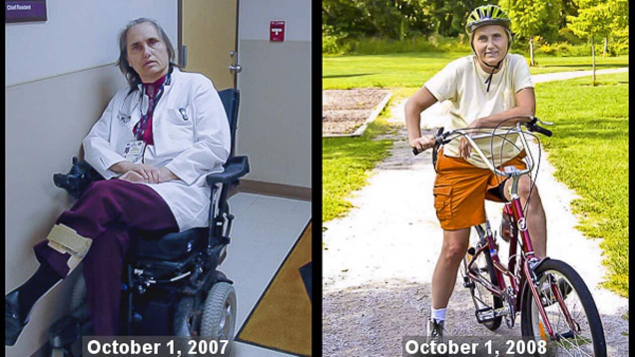 Dr Terry Wahls was diagnosed with MS in 2000, at age 45. Despite declining in her health and condition, over a decade later, she improved her health.