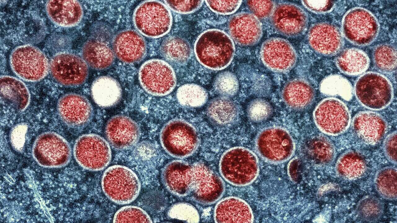 Monkeypox particles within an infected cell.