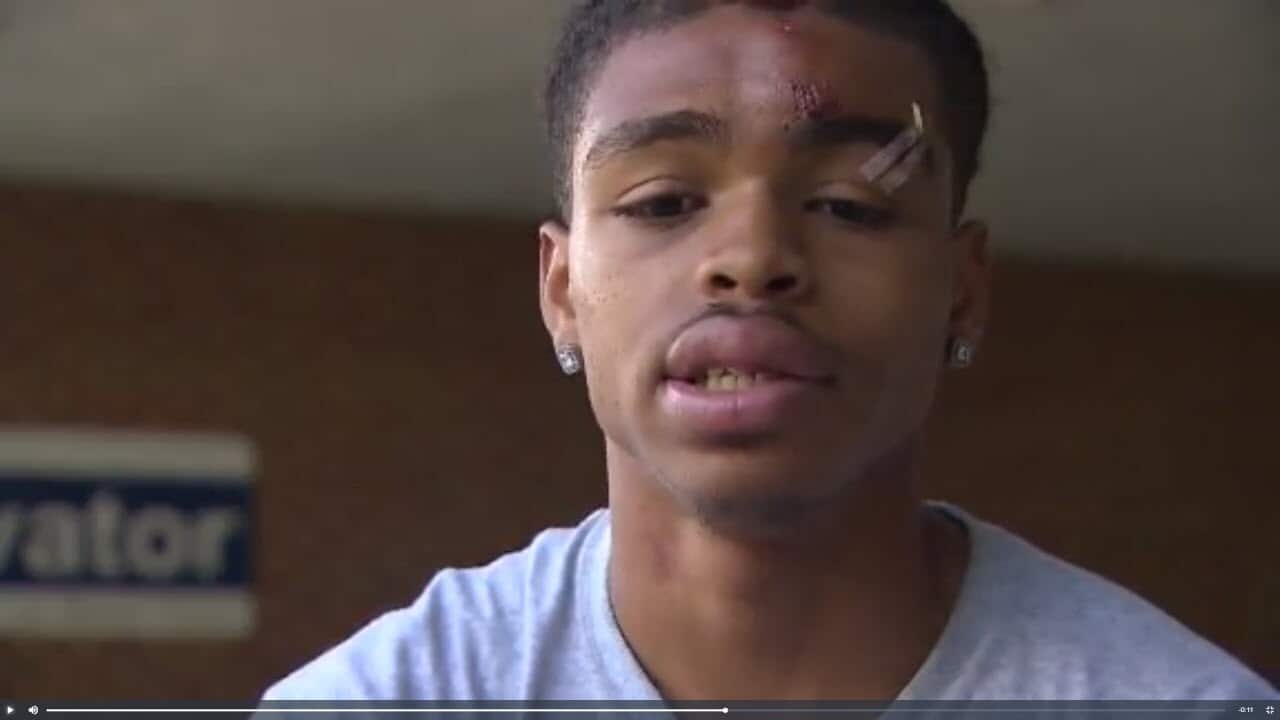 DeAndre Harris says he was brutally bashed by white supremacists at the Charlottesville rally. 