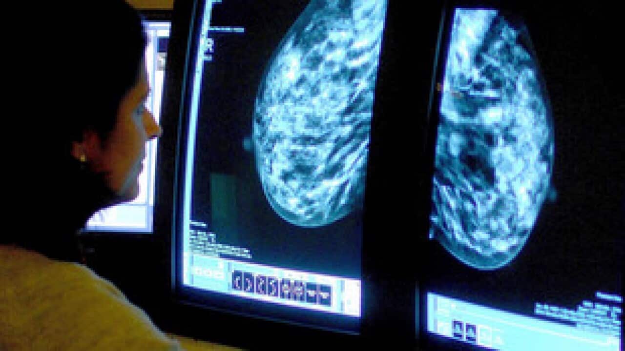 Breast Cancer Photo credit: Rui Vieira/PA Wire