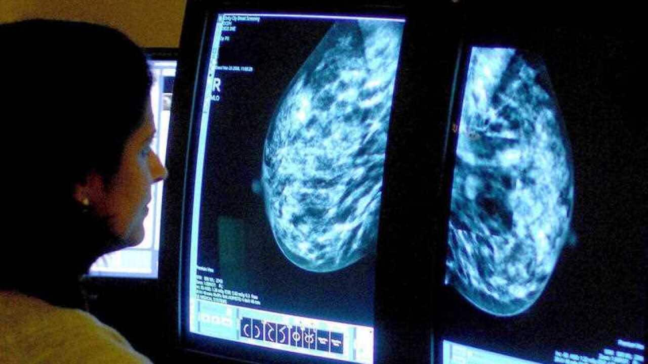 File photo dated 15/06/06 of a consultant analyzing a mammogram.