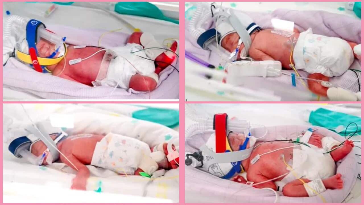 Na'amoana Quadruplets