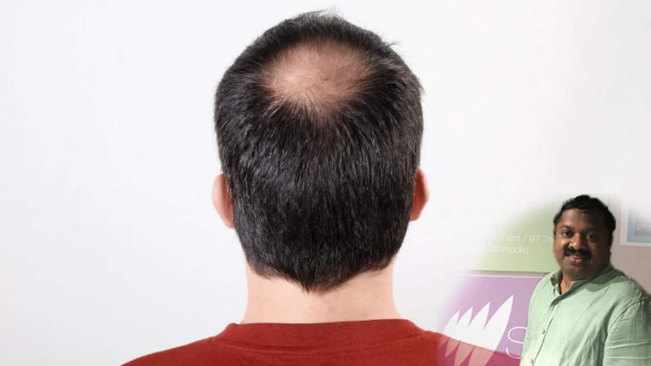 Hair Loss