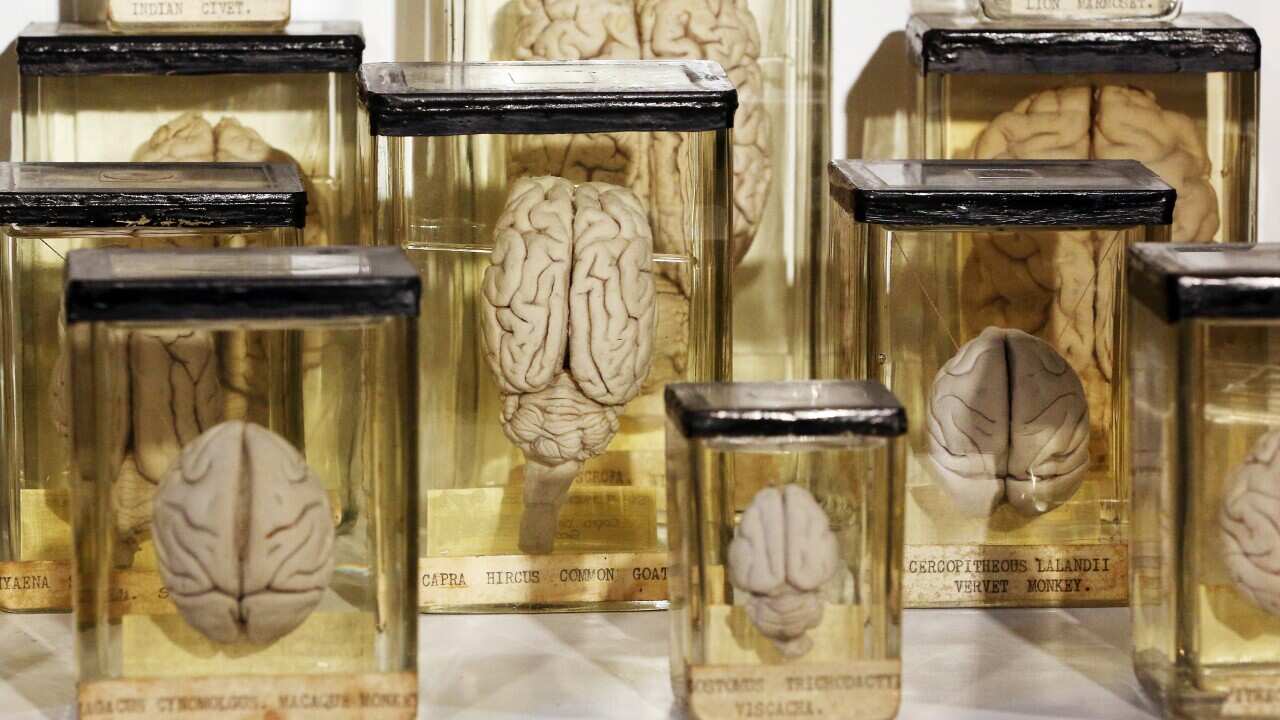 brains_zoology_getty.jpg