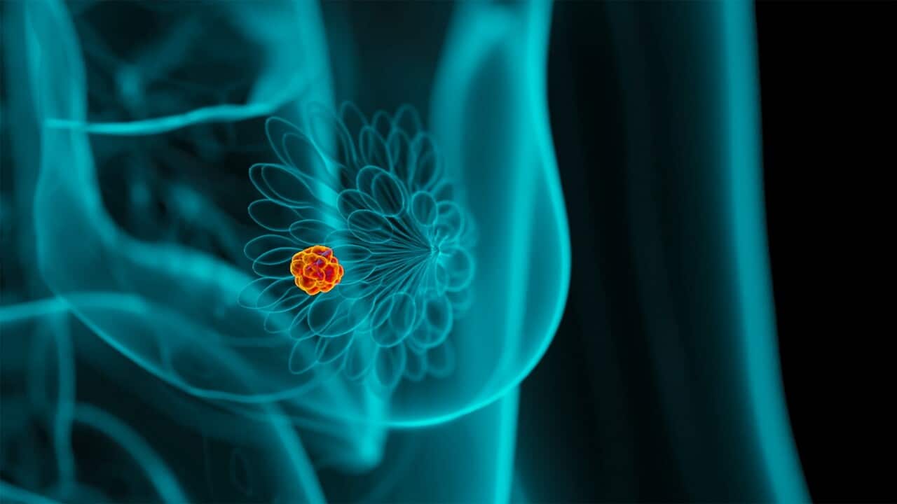 Image for read more article ''