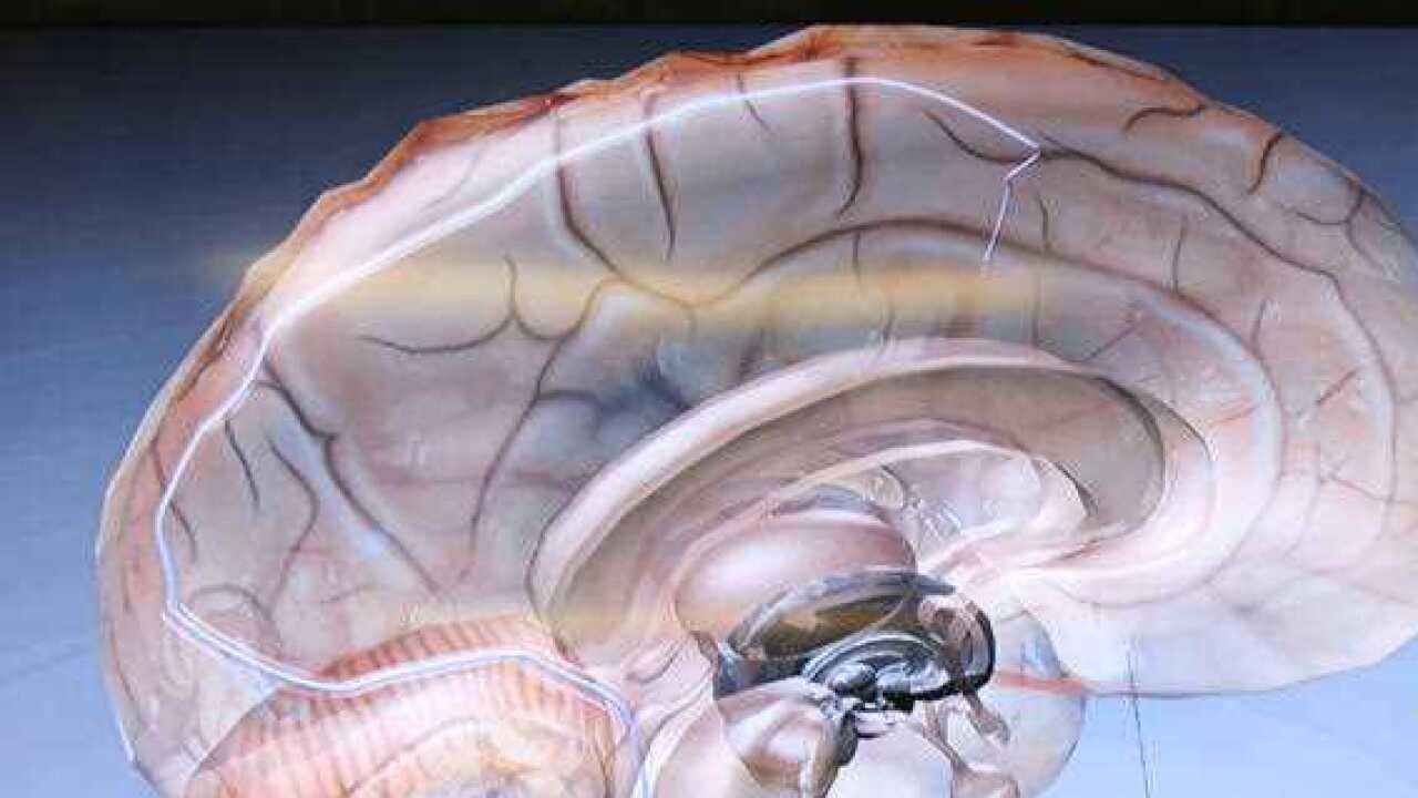 Brain trauma receives funding.