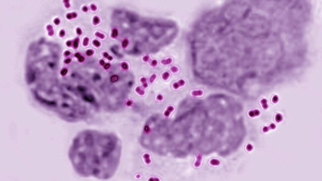 Neisseria Gonorrhoeae