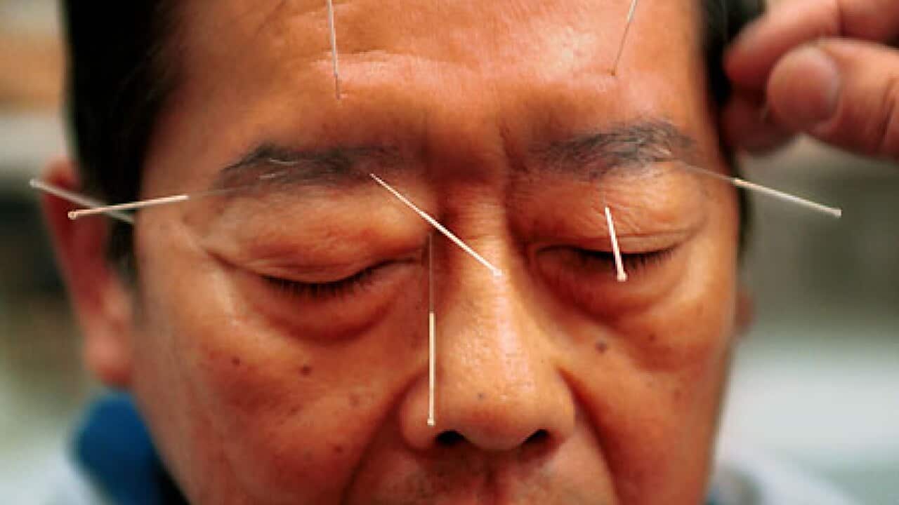 Acupuncture (Supplied)