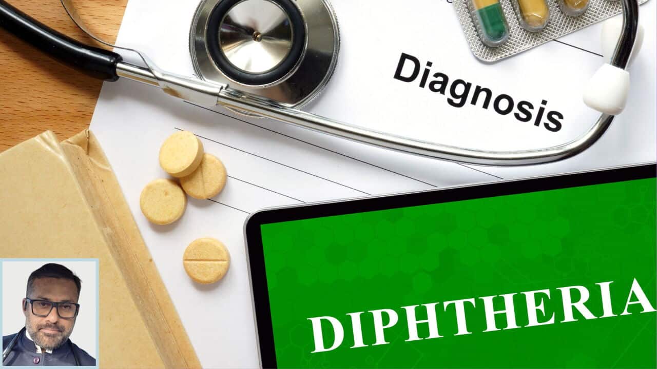 DIPHTHERIA