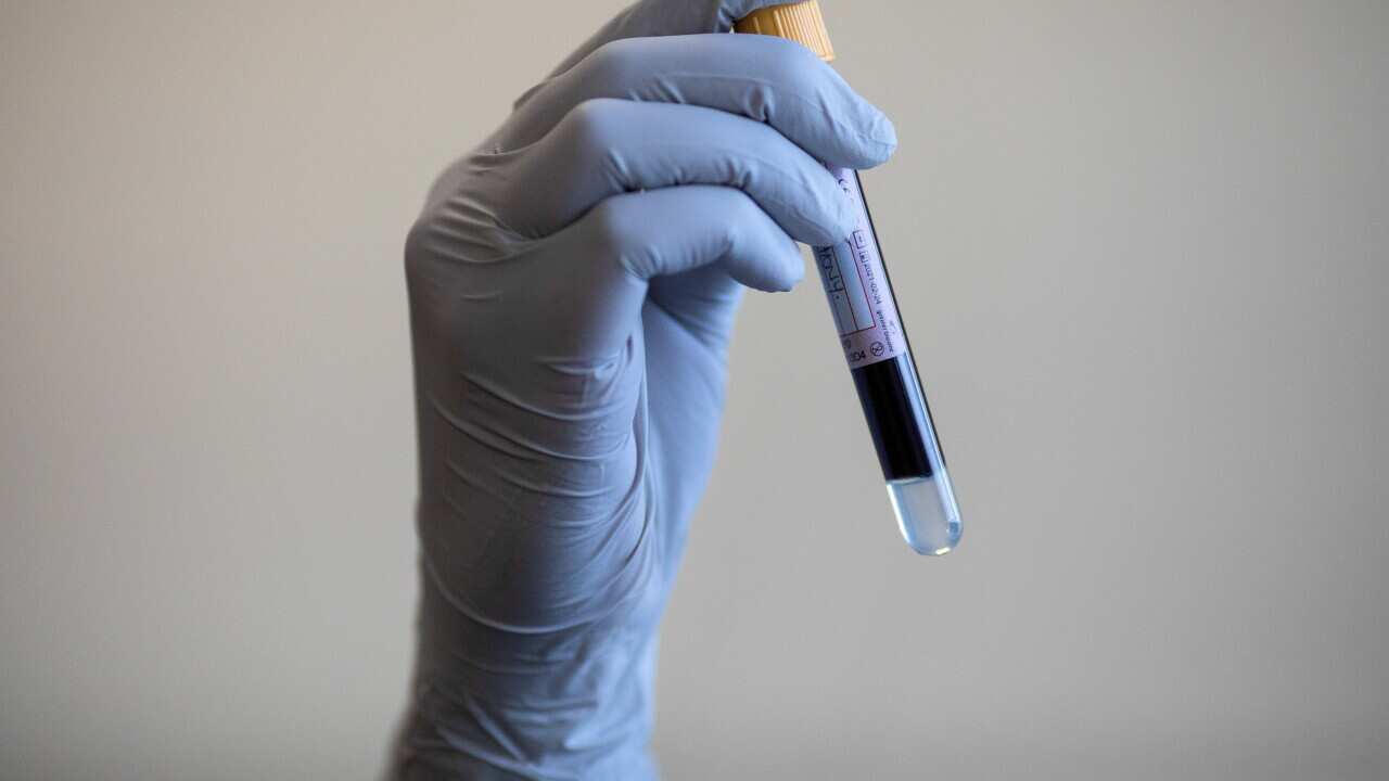 Blood sugar levels study