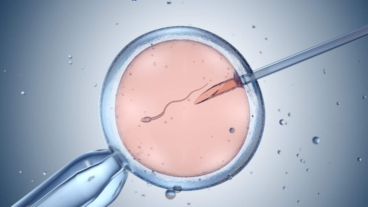 Illustration of artificial insemination or in vitro fertilisation