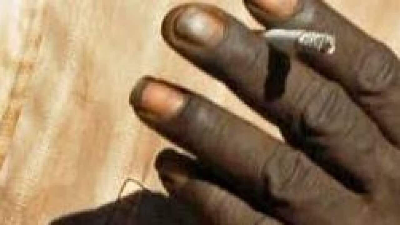 Cancer rates are showing the effects of high Indigenous smoking rates