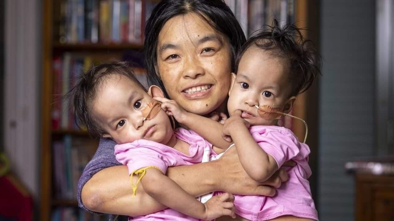 Bhumchu Zangmo with her conjoined twins Nima and Dawa.
