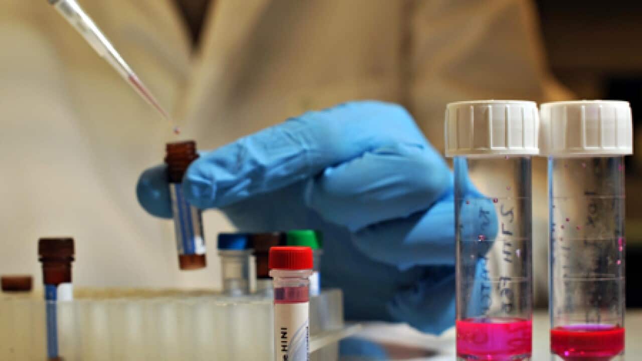 swine_flu_tests_L_2605_getty_593259187