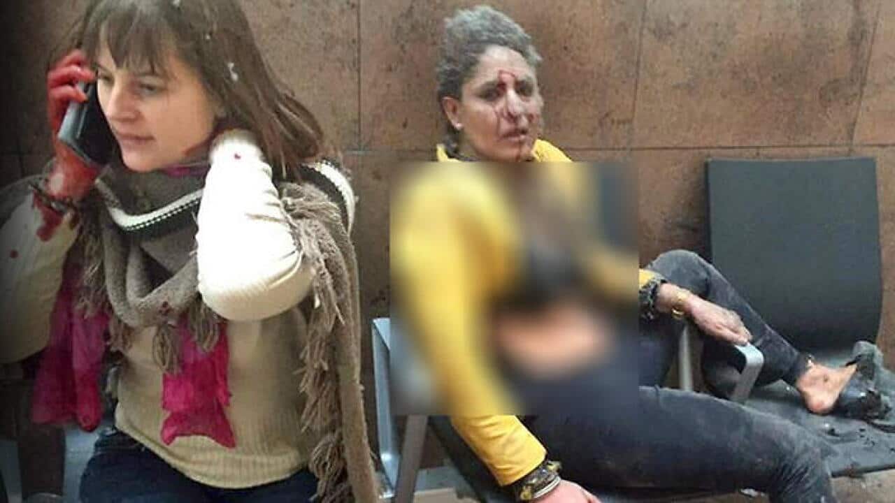 An injured woman at Brussels airport