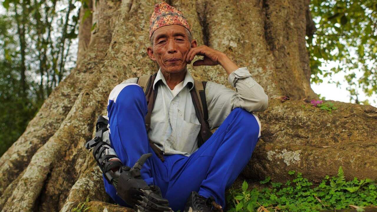 Raj Bahadur Ghale wearing his 3D printed prosthetic arm