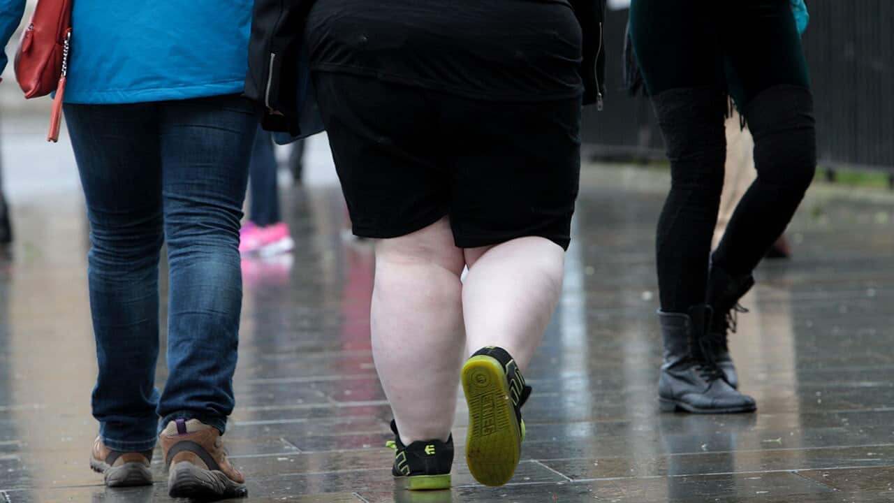 The legs of an overweight woman