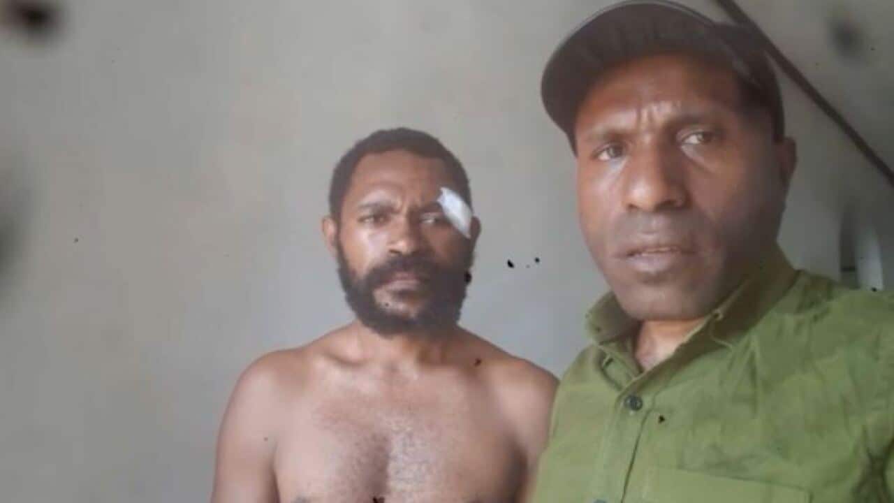 Andi Ogetai says he was injured by pro-government militia. He's pictured with West Papua National Committee activist Victor Yeimo.