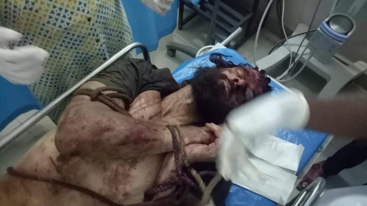 Melbourne man beaten up by villagers