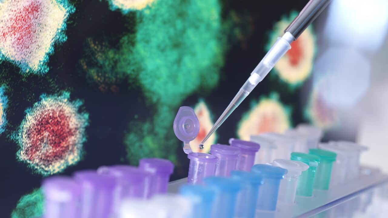Pharmaceutical research into diseases and pandemics. Scientist pipetting a sample into a vial with a electron microscope image of the virus on the screen.