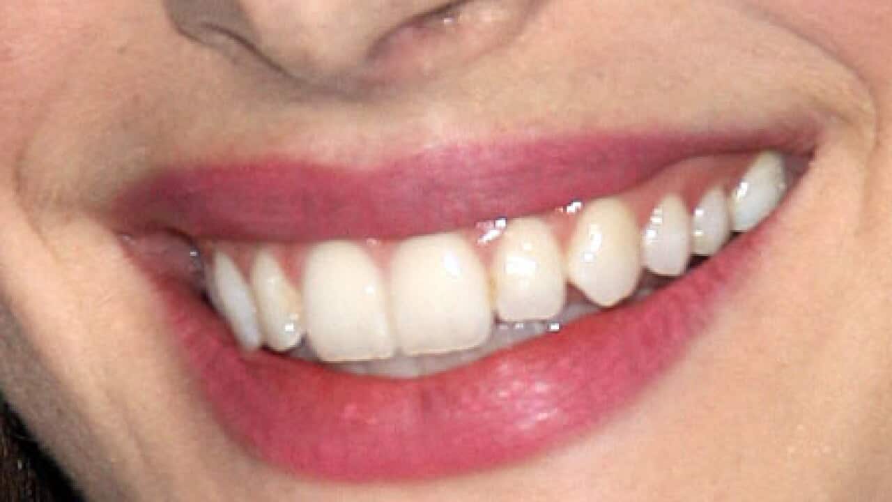 smile_lips_L_101029_aap_1914775506