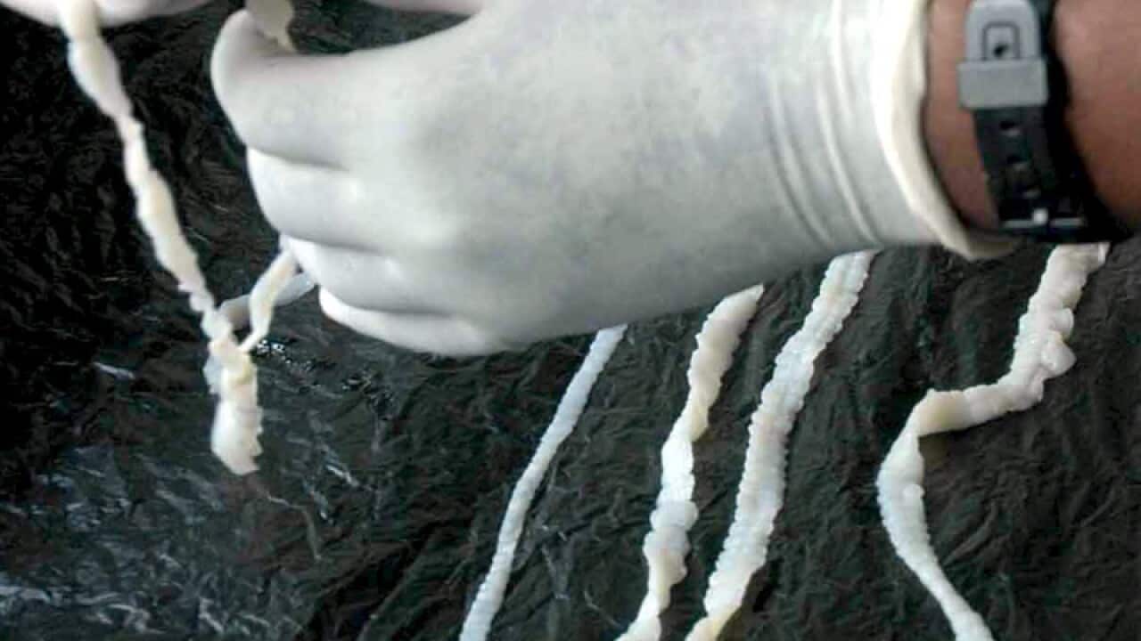 An image of a tapeworm