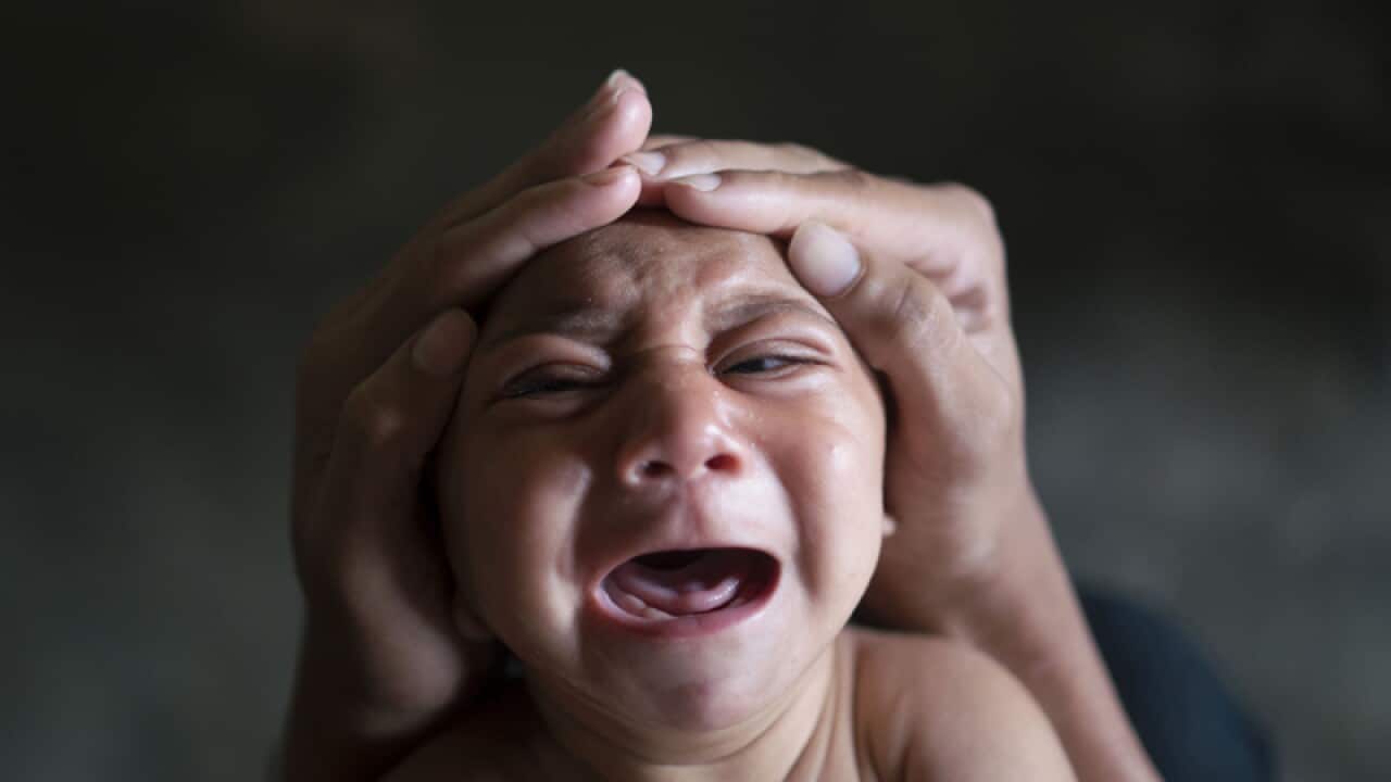 Jose Wesley, who was born with microcephaly