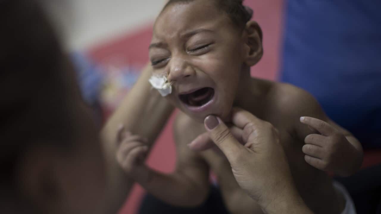 A child who was born with microcephaly